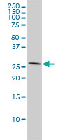 PHAP1 / ANP32A Antibody - Western blot of ANP32A expression in HeLa.