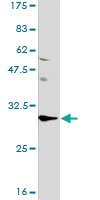 PHAP1 / ANP32A Antibody - Western blot of ANP32A expression in Daudi.