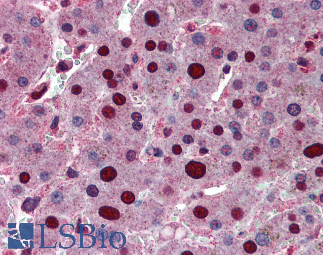 PHAP1 / ANP32A Antibody - Anti-ANP32A antibody IHC of human liver. Immunohistochemistry of formalin-fixed, paraffin-embedded tissue after heat-induced antigen retrieval. Antibody concentration 5 ug/ml.