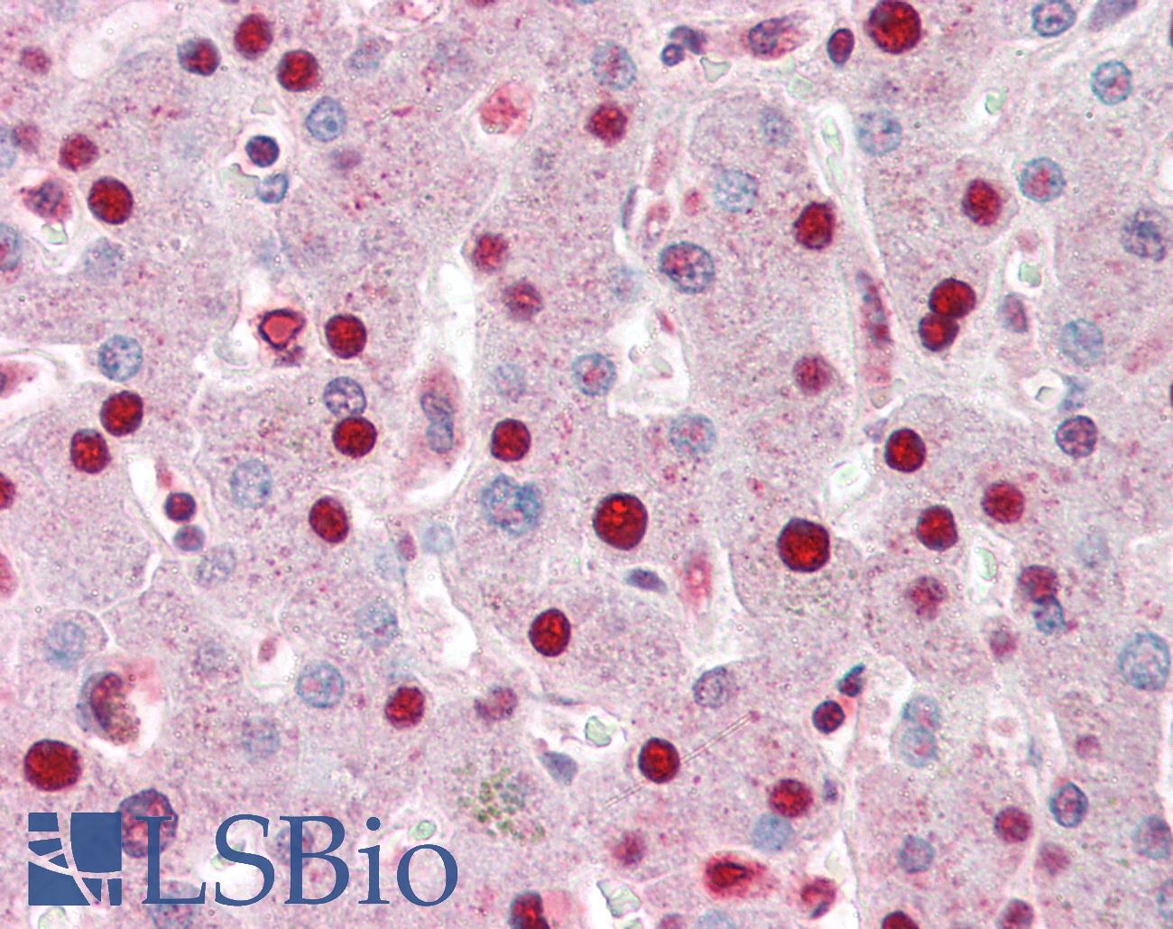 PHAP1 / ANP32A Antibody - Anti-ANP32A antibody IHC of human liver. Immunohistochemistry of formalin-fixed, paraffin-embedded tissue after heat-induced antigen retrieval. Antibody concentration 5 ug/ml.