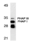 PHAP1 / ANP32A Antibody - Western blot of PHAP expression in human Raji cell lysate with PHAP antibody at 1 ug/ml. The two bands below PHAP I might be differently spliced isoforms of PHAP.