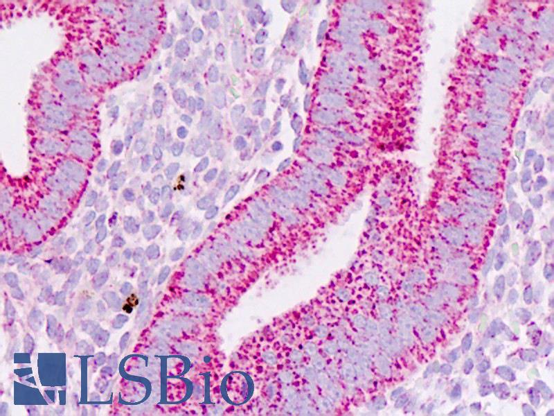 PHB / Prohibitin Antibody - Human Uterus: Formalin-Fixed, Paraffin-Embedded (FFPE)