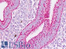 PHB / Prohibitin Antibody - Human Uterus: Formalin-Fixed, Paraffin-Embedded (FFPE)