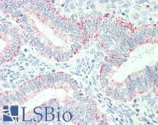 PHB / Prohibitin Antibody - Anti-PHB / Prohibitin antibody IHC staining of human uterus. Immunohistochemistry of formalin-fixed, paraffin-embedded tissue after heat-induced antigen retrieval. Antibody dilution 1:50.