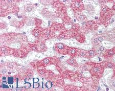 PHB / Prohibitin Antibody - Anti-PHB / Prohibitin antibody IHC of human liver. Immunohistochemistry of formalin-fixed, paraffin-embedded tissue after heat-induced antigen retrieval. Antibody concentration 10 ug/ml.