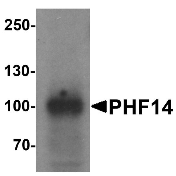 PHF14 Antibody - Western blot analysis of PHF14 in 293 cell lysate with PHF14 antibody at 1 ug/ml.