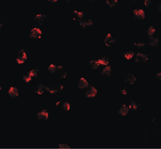 PHF14 Antibody - Immunofluorescence of PHF14 in 293 cells with PHF14 antibody at 5 ug/ml.