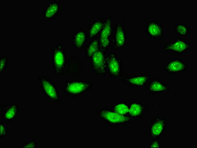PHF5A / INI Antibody - Immunofluorescent analysis of Hela cells using PHF5A Antibody at dilution of 1:100 and Alexa Fluor 488-congugated AffiniPure Goat Anti-Rabbit IgG(H+L)