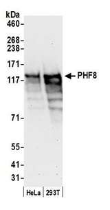 PHF8 Antibody - Detection of human PHF8 by western blot. Samples: Whole cell lysate (50 µg) from HeLa and HEK293T cells prepared using NETN lysis buffer. Antibody: Affinity purified rabbit anti-PHF8 antibody used for WB at 0.04 µg/ml. Detection: Chemiluminescence with an exposure time of 30 seconds.