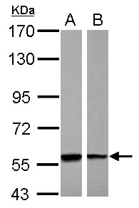 PHGDH Antibody - Sample (30 ug of whole cell lysate) A: A431 B: Raji 7.5% SDS PAGE PHGDH antibody diluted at 1:10000