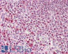 PHLPP2 / PHLPPL Antibody - Anti-PHLPP2 / PHLPPL antibody IHC staining of human spleen. Immunohistochemistry of formalin-fixed, paraffin-embedded tissue after heat-induced antigen retrieval.