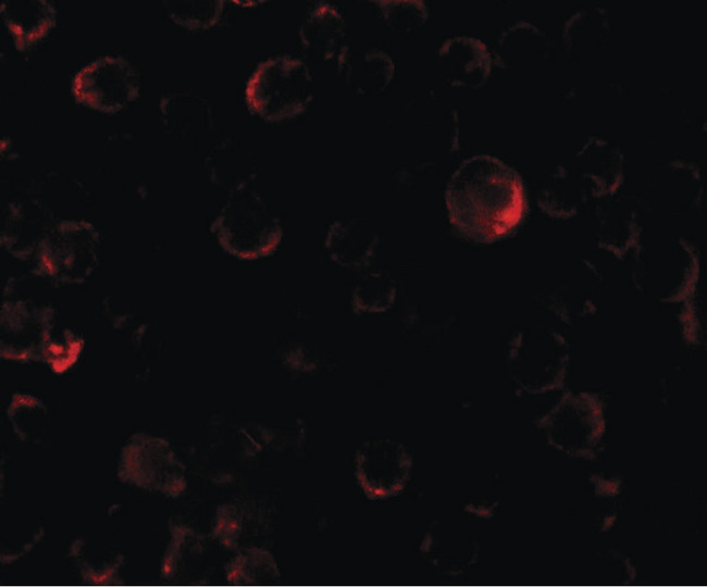 PHLPP2 / PHLPPL Antibody - Immunofluorescence of PHLPP2 in SW480 cells with PHLPP2 antibody at 5 ug/ml.
