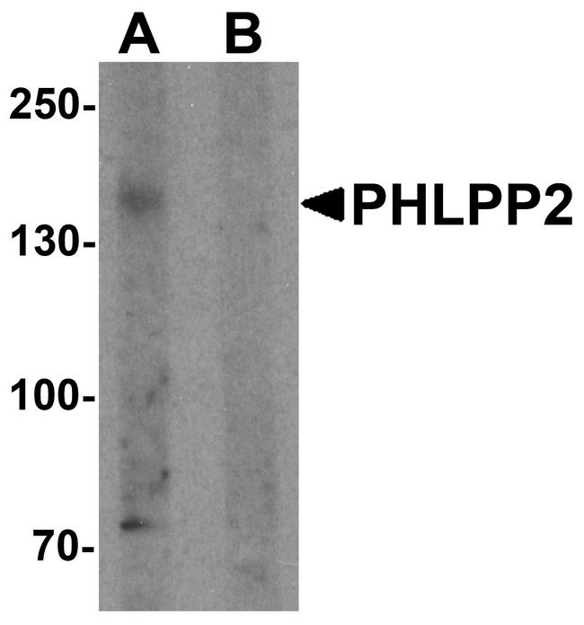 PHLPP2 / PHLPPL Antibody - Western blot analysis of PHLPP2 in SW480 cell lysate with PHLPP2 antibody at 1 ug/ml in (A) the presence and (B) the absence of blocking peptide.