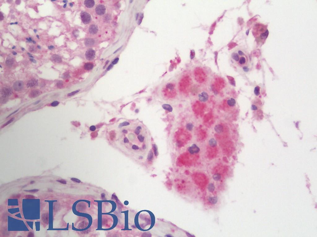 PHPT1 Antibody - Human Testis: Formalin-Fixed, Paraffin-Embedded (FFPE).  This image was taken for the unconjugated form of this product. Other forms have not been tested.