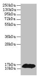 PHPT1 Antibody - Western blot All lanes: 14 kDa phosphohistidine phosphatase antibody at 2µg/ml + MCF-7 whole cell lysate Secondary Goat polyclonal to rabbit IgG at 1/10000 dilution Predicted band size: 13 kDa Observed band size: 13 kDa