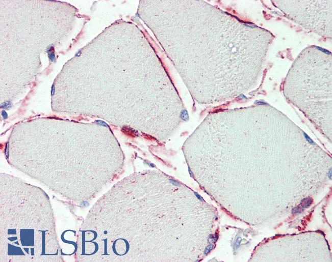 PI15 Antibody - Anti-PI15 antibody IHC staining of human skeletal muscle. Immunohistochemistry of formalin-fixed, paraffin-embedded tissue after heat-induced antigen retrieval. Antibody concentration 5 ug/ml.
