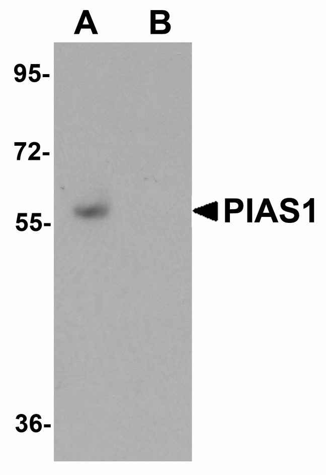 PIAS1 Antibody - Western blot of PIAS1 in human kidney tissue lysate with PIAS1 antibody at 1 ug/ml in (A) the absence and (B) the presence of blocking peptide.