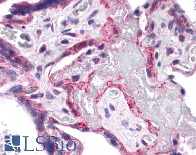 PIAS1 Antibody - Anti-PIAS1 antibody IHC of human placenta. Immunohistochemistry of formalin-fixed, paraffin-embedded tissue after heat-induced antigen retrieval. Antibody concentration 5 ug/ml.