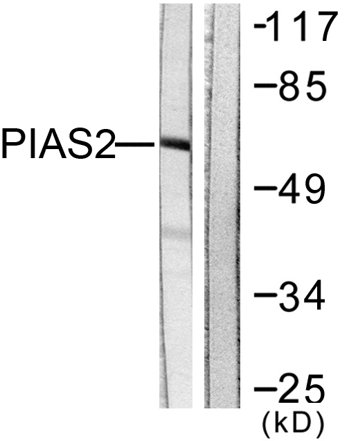 PIAS2 / PIASX Antibody - Western blot analysis of lysates from COS7 cells, using PIAS2 Antibody. The lane on the right is blocked with the synthesized peptide.