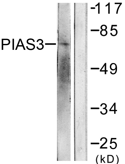PIAS3 Antibody - Western blot analysis of lysates from 293 cells, treated with UV 5', using PIAS3 Antibody. The lane on the right is blocked with the synthesized peptide.