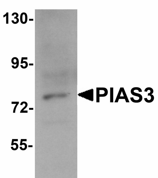 PIAS3 Antibody - Western blot of PIAS3 in K562 cell lysate with PIAS3 antibody at 1 ug/ml.