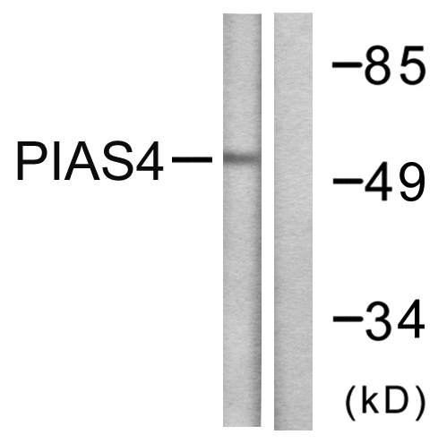 PIAS4 / PIASY Antibody - Western blot analysis of lysates from Jurkat cells, using PIAS4 Antibody. The lane on the right is blocked with the synthesized peptide.
