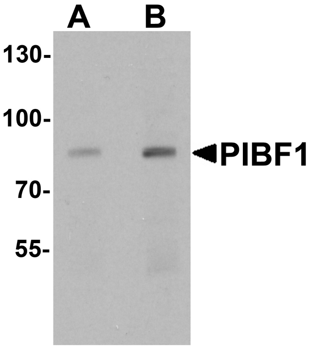 PIBF1 / PIBF Antibody - Western blot analysis of PIBF1 in human placenta tissue lysate with PIBF1 antibody at (A) 1 and (B) 2 ug/ml