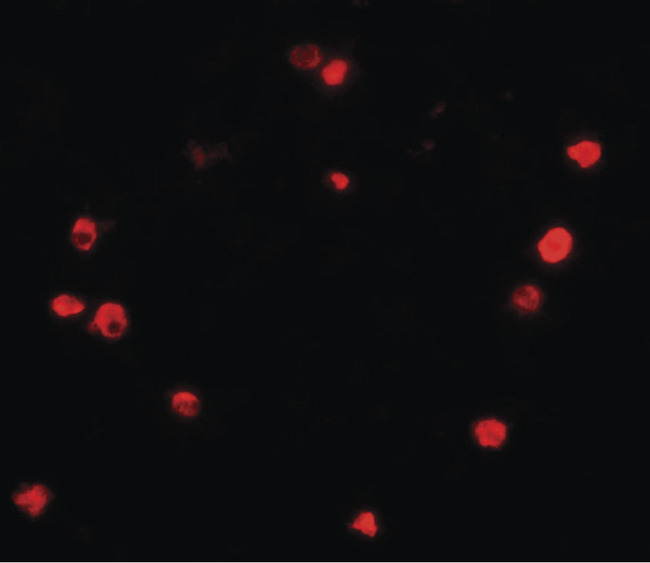 PIBF1 / PIBF Antibody - Immunofluorescence of PBIF in human spleen tissue with PBIF antibody at 20 ug/ml.