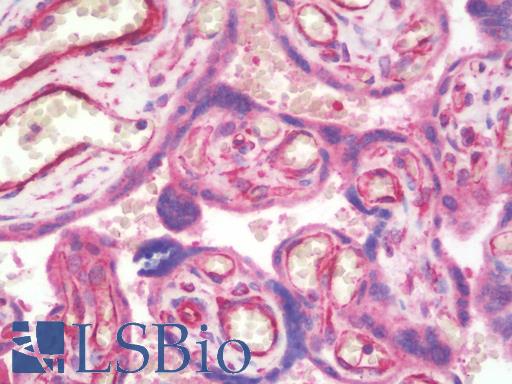 PIBF1 / PIBF Antibody - Anti-PIBF1 / PIBF antibody IHC staining of human placenta. Immunohistochemistry of formalin-fixed, paraffin-embedded tissue after heat-induced antigen retrieval. Antibody concentration 10 ug/ml.