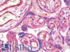 PIBF1 / PIBF Antibody - Anti-PIBF1 / PIBF antibody IHC staining of human placenta. Immunohistochemistry of formalin-fixed, paraffin-embedded tissue after heat-induced antigen retrieval. Antibody concentration 10 ug/ml.