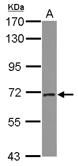 PICALM / CALM Antibody - Sample (30 ug of whole cell lysate) A: A549 7.5% SDS PAGE PICALM antibody diluted at 1:2000