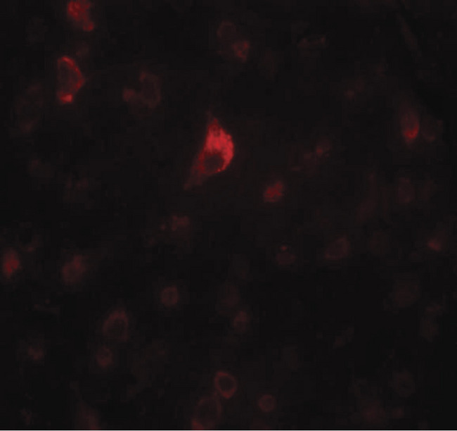 PICALM / CALM Antibody - Immunofluorescence of PICALM in human brain tissue with PICALM antibody at 20 ug/ml.