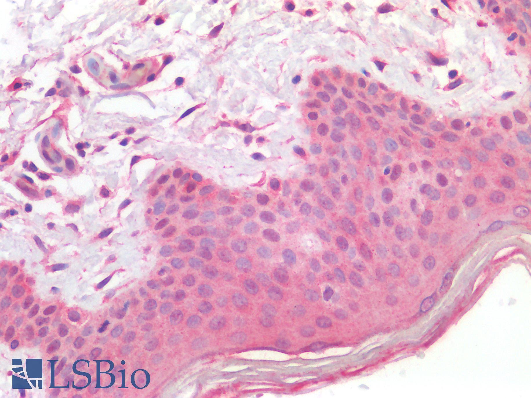 PIEZO2 / FAM38B Antibody - Human Skin, positive staining in epidermis: Formalin-Fixed, Paraffin-Embedded (FFPE)