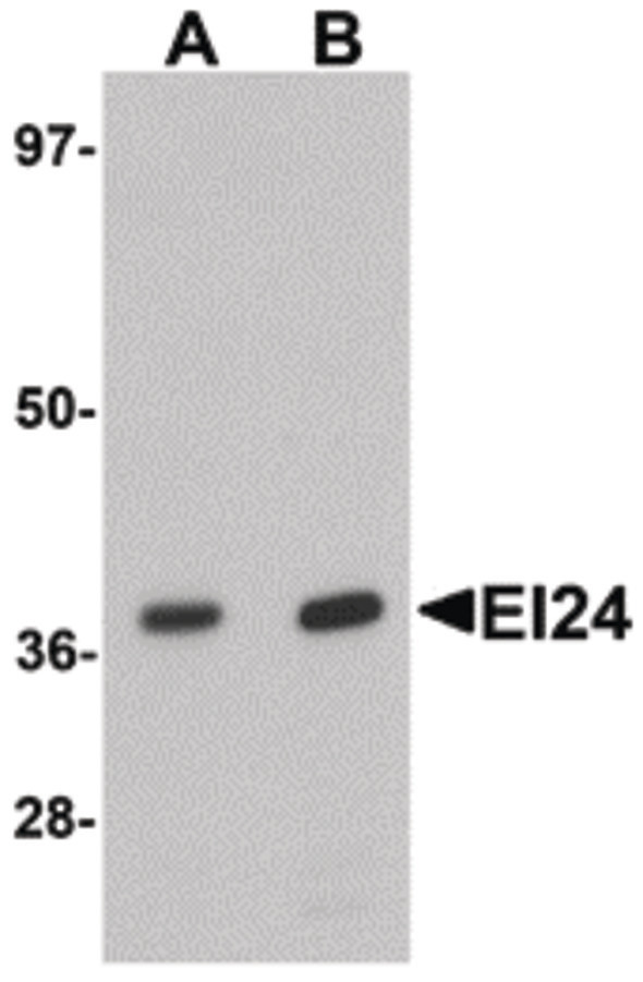 PIG8 / EI24 Antibody - Western blot of EI24 in rat liver tissue lysate with EI24 antibody at (A) 1 and (B) 2 ug/ml.