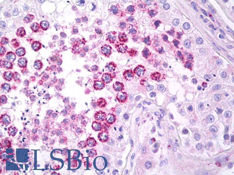 PIG8 / EI24 Antibody - Anti-EI24 / PIG8 antibody IHC of human testis. Immunohistochemistry of formalin-fixed, paraffin-embedded tissue after heat-induced antigen retrieval. Antibody concentration 5 ug/ml.