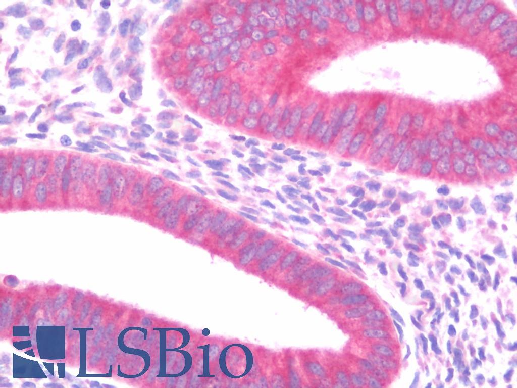 PIGR Antibody - Anti-PIGR antibody IHC staining of human uterus, endometrium. Immunohistochemistry of formalin-fixed, paraffin-embedded tissue after heat-induced antigen retrieval. Antibody concentration 10 ug/ml.