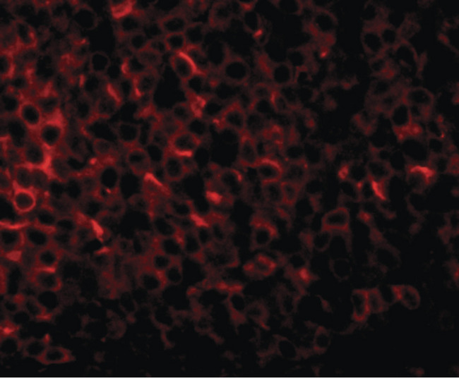 PIGY Antibody - Immunofluorescence of PIGY in human spleen tissue with PIGY1 antibody at 20 ug/ml.