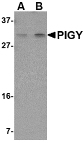 PIGY Antibody - Western blot of PIG-Y in human spleen tissue lysate with PIG-Y antibody at (A) 1 and (B) 2 ug/ml.