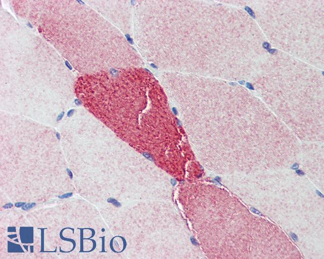PIGY Antibody - Anti-PIGY antibody IHC of human skeletal muscle. Immunohistochemistry of formalin-fixed, paraffin-embedded tissue after heat-induced antigen retrieval. Antibody concentration 5 ug/ml.