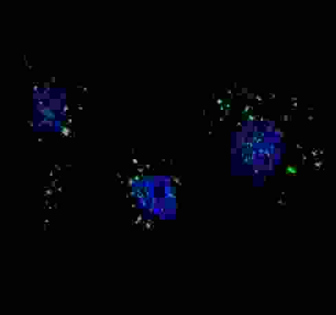PIK3C3 / VPS34 Antibody - Fluorescent image of U251 cells stained with PI3KC3 (S34) antibody. U251 cells were treated with Chloroquine (50 mu M,16h), then fixed with 4% PFA (20 min), permeabilized with Triton X-100 (0.2%, 30 min). Cells were then incubated PI3KC3 (S34) primary antibody (1:200, 2 h at room temperature). For secondary antibody, Alexa Fluor 488 conjugated donkey anti-rabbit antibody (green) was used (1:1000, 1h). Nuclei were counterstained with Hoechst 33342 (blue) (10 ug/ml, 5 min). PI3KC3 immunoreactivity is localized to autophagic vacuoles in the cytoplasm of U251 cells.