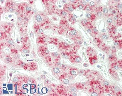 PIK3C3 / VPS34 Antibody - Human Liver: Formalin-Fixed, Paraffin-Embedded (FFPE)