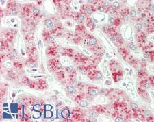 PIK3C3 / VPS34 Antibody - Human Liver: Formalin-Fixed, Paraffin-Embedded (FFPE)