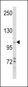 PIK3C3 / VPS34 Antibody - Western blot of Phospho-PI3KC3-pS425 in MDA-MB231 cell line lysates (35 ug/lane). PI3KC3 (arrow) was detected using the purified antibody.