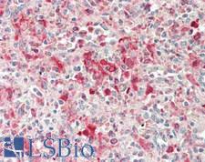 PIK3CD / PI3K Delta Antibody - Human Spleen: Formalin-Fixed, Paraffin-Embedded (FFPE)