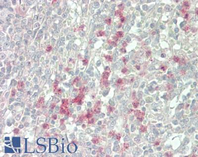 PIK3CG / PI3K Gamma Antibody - Human Spleen: Formalin-Fixed, Paraffin-Embedded (FFPE)