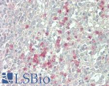 PIK3CG / PI3K Gamma Antibody - Human Spleen: Formalin-Fixed, Paraffin-Embedded (FFPE)