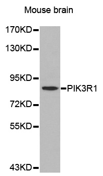 PIK3R1 / p85 Alpha Antibody - Western blot analysis of extracts of brain tissues, using PIK3R1 antibody.