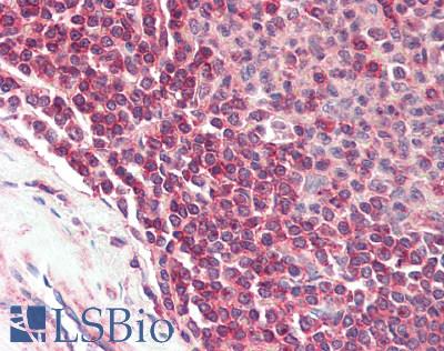 PIK3R5 Antibody - Human Spleen: Formalin-Fixed, Paraffin-Embedded (FFPE), at a concentration of 10 ug/ml.