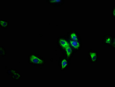 PIK3R5 Antibody - Immunofluorescence staining of HepG2 cells with PIK3R5 Antibody at 1:200, counter-stained with DAPI. The cells were fixed in 4% formaldehyde, permeabilized using 0.2% Triton X-100 and blocked in 10% normal Goat Serum. The cells were then incubated with the antibody overnight at 4°C. The secondary antibody was Alexa Fluor 488-congugated AffiniPure Goat Anti-Rabbit IgG(H+L).