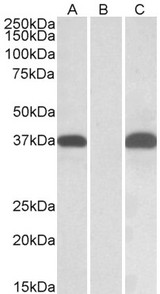 PIM2 / Pim-2 Antibody - HEK293 lysate (10ug protein in RIPA buffer) overexpressing Human PIM2 with C-terminal MYC tag probed with (0.1ug/ml) in Lane A and probed with anti-MYC Tag (1/1000) in lane C. Mock-transfected HEK293 probed (0.1mg/ml) in Lane B. Prima